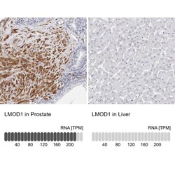 LMOD1 Antibody, Novus Biologicals 25 &mu;L; Unlabeled:Antibodies, Polyclonal
